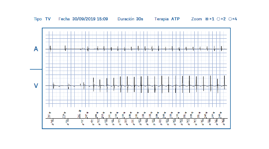 GALI Gali 3 ES 540x300 1