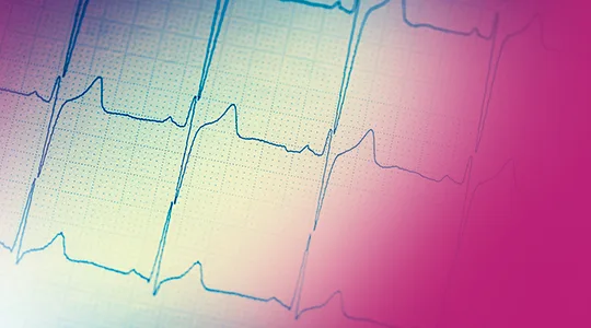 Coronariopatía DIAGNOSIS 1